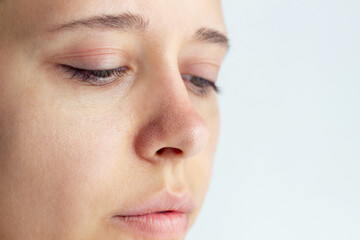 Young woman with blackheads or black dots on her nose isolated on a white background. Acne problem, comedones. Enlarged pores on the face. Cosmetology dermatology concept