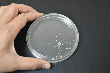 Colonies of bacteria growth on agar plate medium in laboratory.