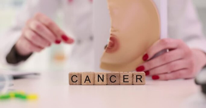 Doctor oncologist holding anatomical model of female breast and writing word cancer in clinic closeup 4k movie slow motion. Prevention and treatment of oncological diseases concept