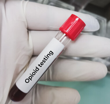 Blood sample for Opioid drug test