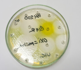 Antimicrobial susceptibility testing, Pseudomonas aeruginosa in culture plate. Drug sensitivity test, disk drug, antibiotic sensitivity, Nitrofurantoin resistance.