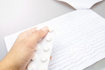 Closeup eclectroencephalogram graph on paper, epilepsy diagnosis