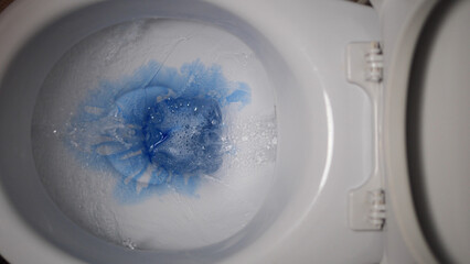 Experience the process of applying blue toilet cleaner into the toilet bowl, promoting germ-free and fresh restroom. Elevate your hygiene standards with this effective sanitation solution