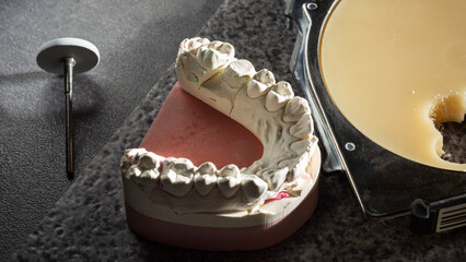 The work of a dental technician in a laboratory. Plaster model of jaw and teeth.