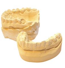 Isolated dental plaster cast model of human teeth on a white background