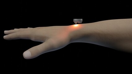 Photoplethysmography optoelectronic sensor. PPG detecting blood flow under skin.  Non-invasive biomedical monitoring technology. 3d render illustration