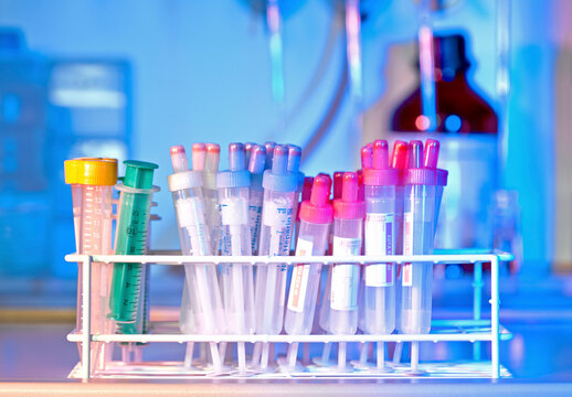 Lab test tubes on a rack illuminated with blue light
