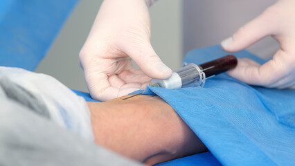 Close-up of blood collection in a clinic or cosmetology center. The concept of health, youth and modern cosmetology technologies.