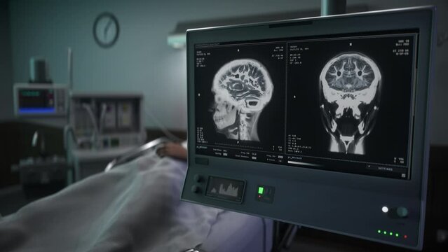Diagnostic scanner looking for cancer growth in the patients head. Diagnostic scanner identifies the cancerous cells in the brain. Diagnostic scanner used for treatment of the cancer patient.