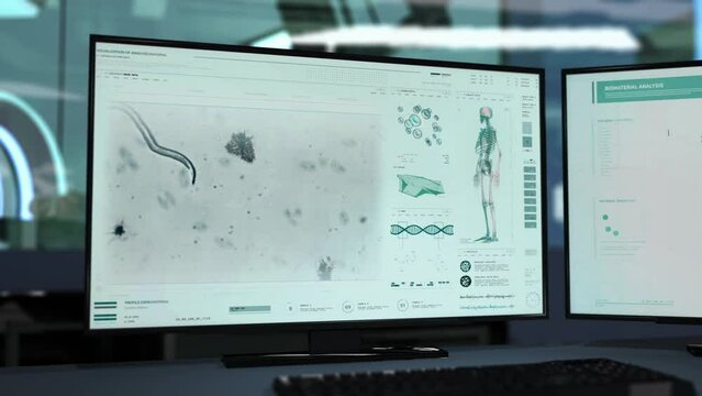Virology Analysis System Examining Parasitic Worm In Patients Organism. Visualization Of Parasitic Worm In Virology Analysis Software. Virology Analysis Laboratory Scanner Researching Parasitic Worm
