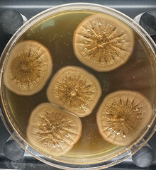 Petri dish with molds, penicillium, yeast, mucor isolated on black
