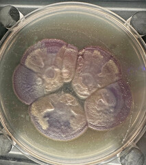 Petri dish with molds, penicillium, yeast, mucor isolated on black