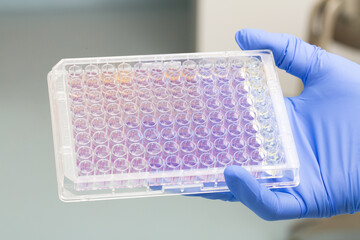 laboratory technician holding a microtiter plate with samples