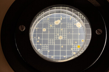bacterial colonies in petri dish for scientific research