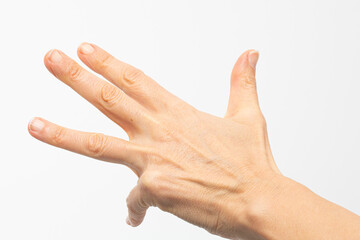 close-up of hand showing signs of arthritis against white background