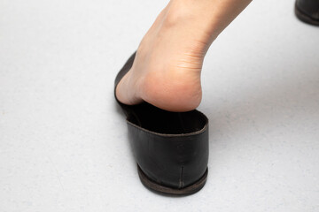 Dry Heel Skin Up Close in a Black Slip-on Shoe