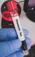 Blood sample for Ethambutol Quantitative test. TB Sensitivity test.