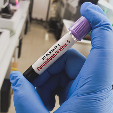 Blood sample for RT PCR Parainfluenza Virus 5 test.