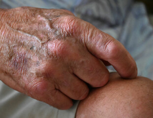 Hand of an Older Male Person