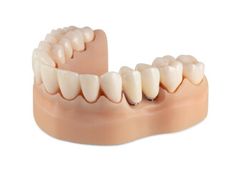 Bottom row of teeth isolated on white background. Dental model of teeth. Ceramic crowns on silicone gums.
