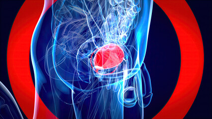 Abstract 3D illustration of the bladder cancer - 757799427