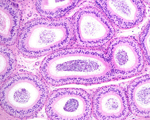 Epididymis