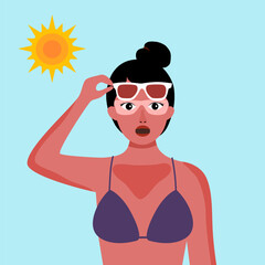Young woman with skin sunburn under strong sunlight in flat design.