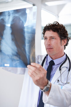 Doctor, man and xray in hospital to check results with thinking for lungs, decision and healthcare. Professional medic, reading and film paper with respiratory system exam for asma at wellness clinic