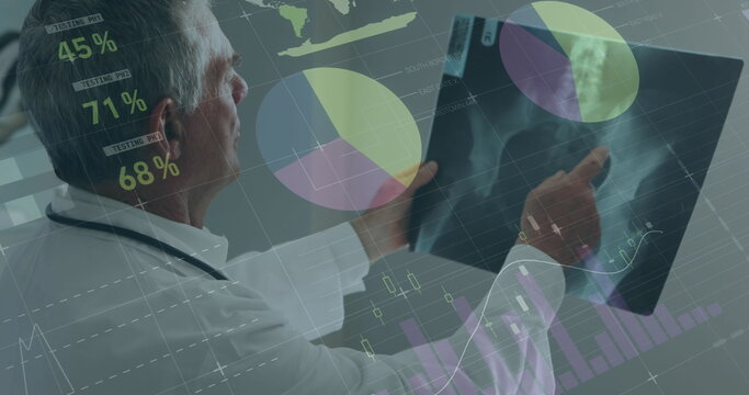 Image of financial graphs over caucasian male doctor with x ray photo - Powered by Adobe