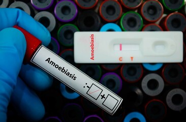 Blood sample of patient negative tested for amoebiasis by rapid diagnostic test.