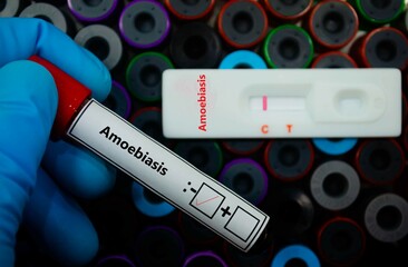 Obraz premium Blood sample of patient negative tested for amoebiasis by rapid diagnostic test.