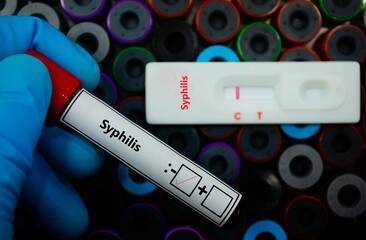 Blood sample of patient negative tested for syphilis by rapid diagnostic test.