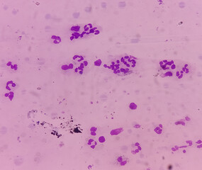 Blood cells and smear, white blood cells, platelets, and abnormal red blood cells and white blood...