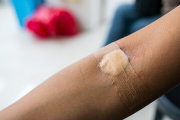 Plaster and cotton on woman arm after blood testing or blood donation - 758124838