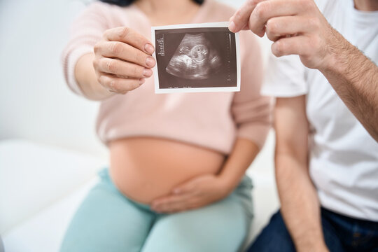 Couple sitting on examination couch and holding baby ultrasonography picture