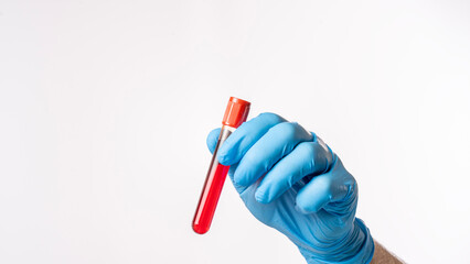 Red vacuum tube with blood test of patient in hand of medical worker on white background.