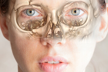 MRI of the skull in 3d with a fracture on the forehead from a fall on the girl s face, a crack on...