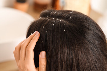 Naklejka premium Young woman with dandruff problem in light bathroom, closeup