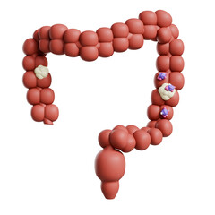 Colon infected with Cancer cell 3D Illustration