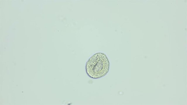 Larva sea urchin Strongylocentrotus pallidus under microscope, phylum Echinodermata. Blastula stage, locking half. White sea