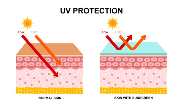 UV Protection. The difference between skin without sunscreen lotion and skin with sun protection lotion. UVA and UVB of skin damage.