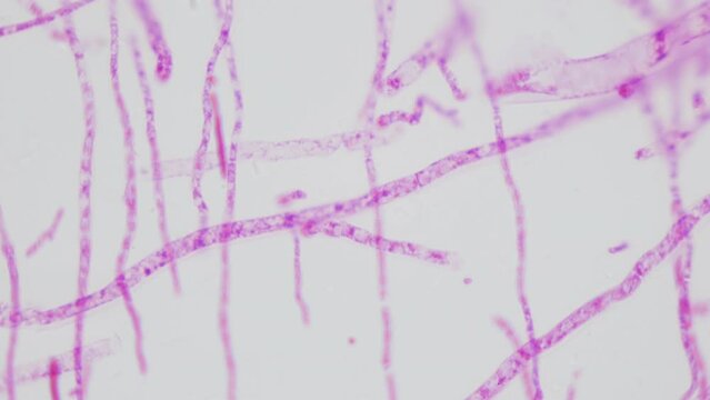 Producers of antibiotic penicillin. Mold under microscope. Detailed anatomy of fungi of genus Penicillium. Multiple magnification. Toxic metabolites.Three-tiered tassels with conidia, complete mushrom