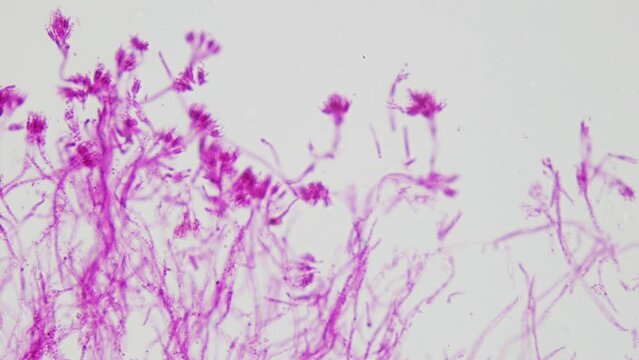 Penicillium. Producers of the antibiotic penicillin under microscope. Anatomy of fungi of the genus Penicillium. 100x times magnification. Enzyme production, medicine usage. Three-tiered tassels