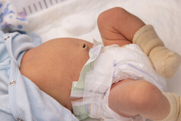 The navel of a newborn baby. Closeup. First weeks of life.