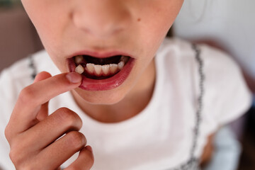 young girl points at loose tooth