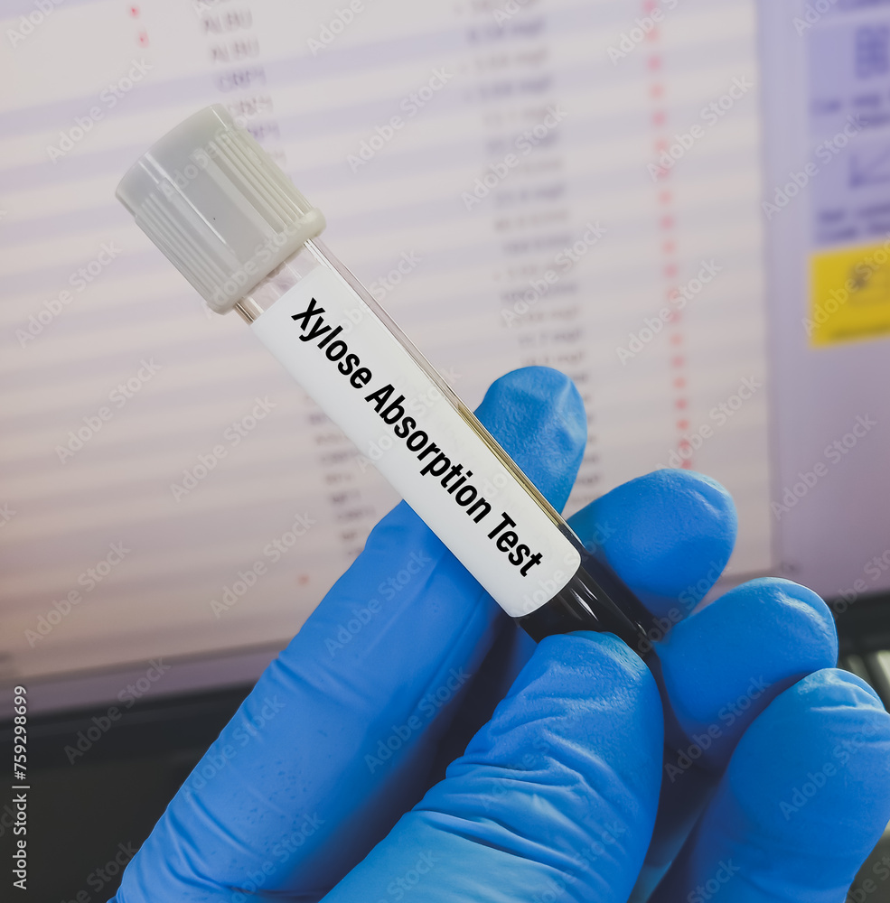 Sticker Blood sample for Xylose Absorption test, to help diagnose malabsorption disorders, that affect your ability to digest and absorb nutrients from food. xylose tolerance test, D-xylose test.