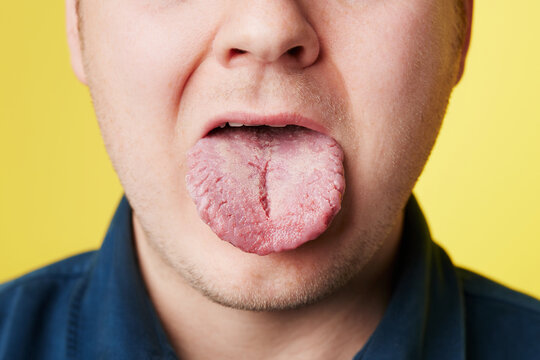 this is what your tongue says about you