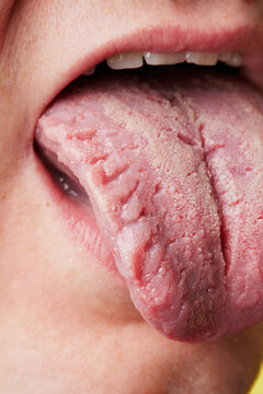 this is what your tongue says about you