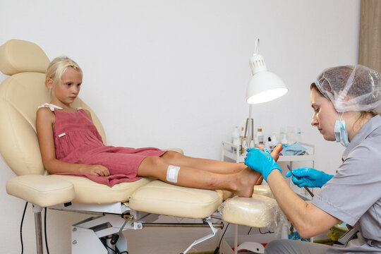 Cosmetic surgery on a child's foot