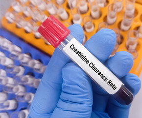 Blood sample for Creatinine clearance rate (CCR) test, used to measure kidney function.